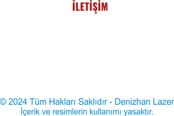 Lazer Baskı İstanbul